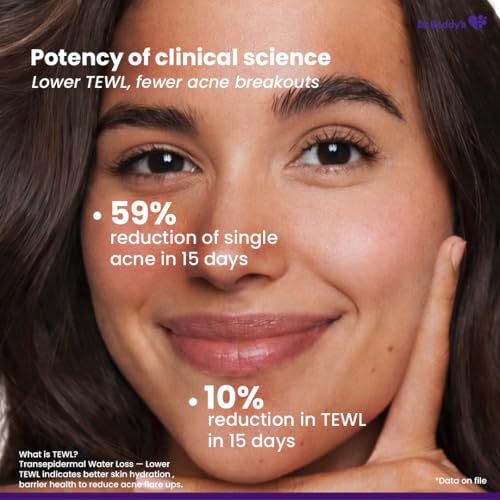 Image of Dr. Reddy's Venusia Acne Facewash | Sebum Control & Hydrating Formula | Clears Acne-marks | Enriched with encapsulated Salicylic Acid, Glycolic Acid, Ceramide - Oat - HA Complex | Oily & Acne-Prone Skin | 75g