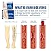 Varicose Veins Treatment Cream for Legs Natural Ingredients, Suitable for Most Skin Types