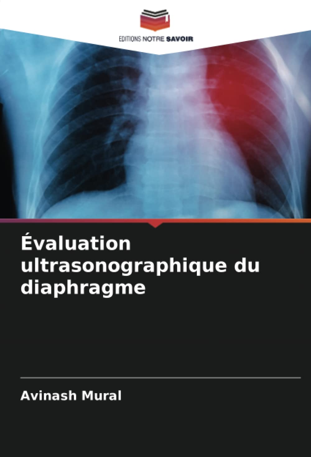 Évaluation ultrasonographique du diaphragme: DE