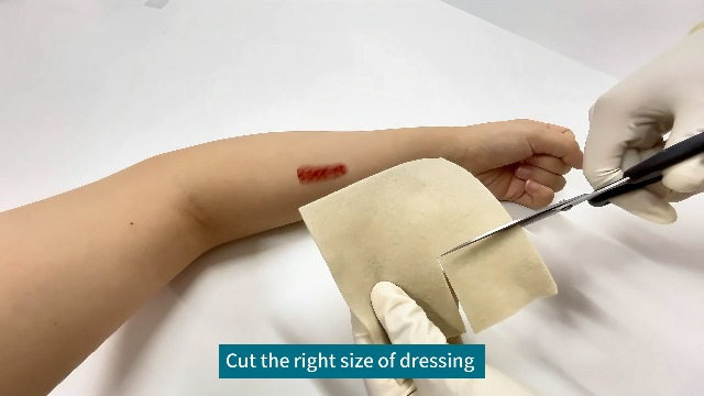 how to use silver calcium alginate wound dressing Dimora Calcium Alginate Wound Dressing 4" x 4"