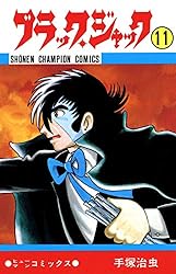 Amazon.co.jp: ブラック・ジャック 12 ブラック・ジャック (少年