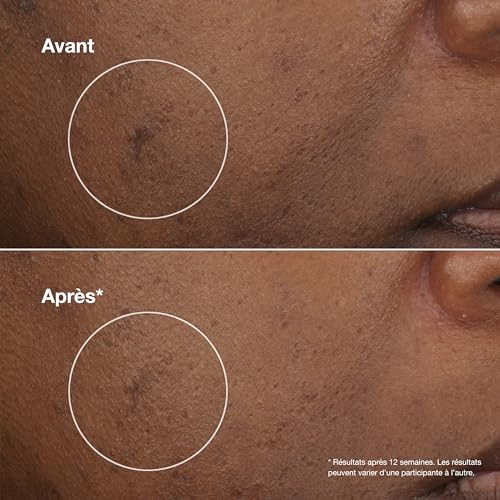 Even Better Clinical brightening moisturizer 50 ml - vue 5