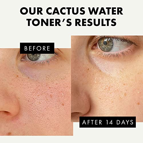 Hydrating Toner For Face W Niacinamide + Aloe + Hyaluronic Acid, Daily Clarifying Toner For Dry & Sensitive Skin, Alcohol Free, Calming Face Toner For Women Anti Aging, Acne Facial Toner For Oily Skin #TOP2