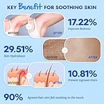 After Shave for Women: Post-Shave Soothing Serum for Face Legs Bikini Arms to Reduce Redness - Image 5