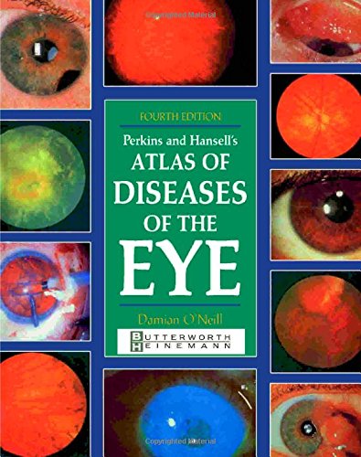 Buy Perkins and Hansell's Atlas of Diseases of the Eye — BookShops.in