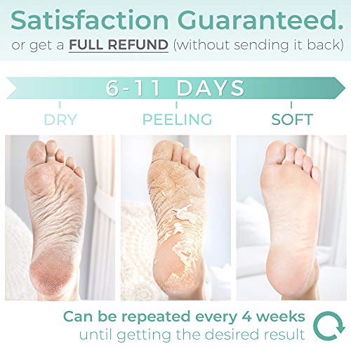 Peach Foot Peel Mask - 2 Pack - For Cracked Heels, Dead Skin & Calluses-Make Your Feet Baby Soft- Removes & Repairs Rough Heels, Dry Toe Skin-Exfoliating Peeling Natural Treatment