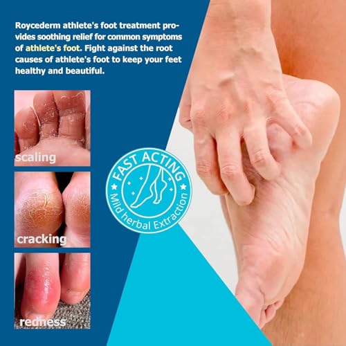 Image of RoyceDerm Extra Strength Athletes Foot Treatment Cream - Powerful Antifungal Relief for Itching and Burning - Suitable for Men and Women