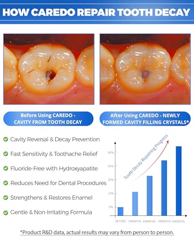 CAREDO Reparatur von Zahnspangen, Zahnkaries, Remineralisierung, Hydroxyapa, Zahnpasta – Bild 3