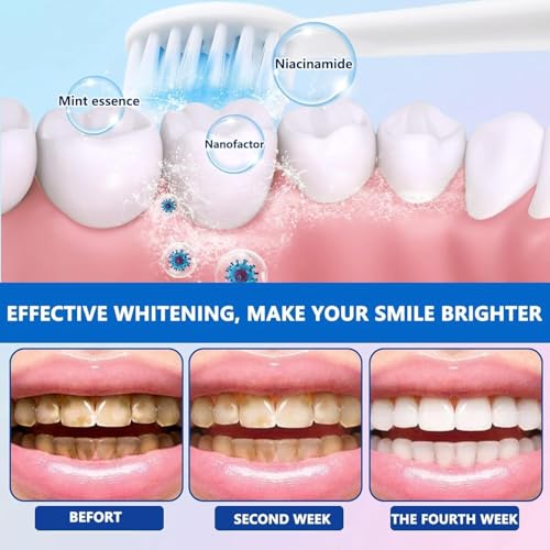 2 Stück Nicotinamid-Zahnpasta: Radiant Aufhellung, Niacinamide-Whitening, Tiefenreinigung, Intensive Weichzeichnung der Zähne und frischer Atem – Bild 3