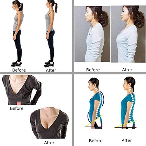 Slimbelle Women Sleeveless Posture Corrector Bra Chest Support Vest Back Brace Compression Shaper Black M #TOP1