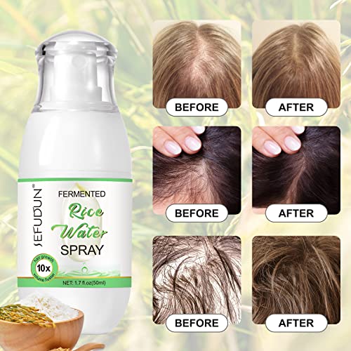 Rtbyue Rice Water Hair Growth Treatment|Fermented Rice Water Spray|Hair Growth Serum With Biotin And Castor Oil Scalp Spray For Thinning Hair And Hair Loss 1.7 Fl.oz/50G #TOP4