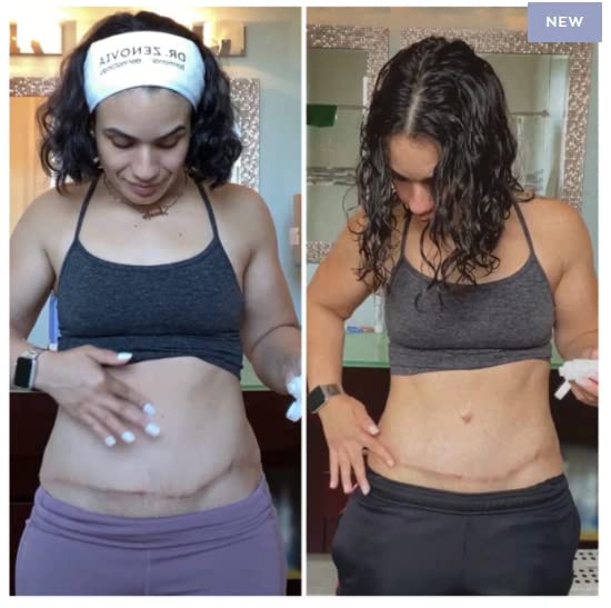 Miniatura 6 de Dr Zenovia Tratamiento de gel para cicatrices