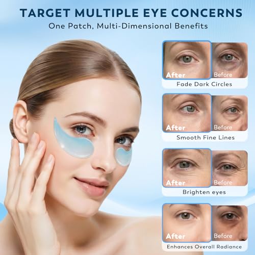 Aeryea Retinol Collagen Under Eye Patches for Men & Women 30 Pairs — view 5