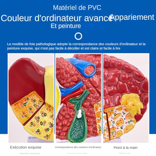 Modèle anatomique du foie pour expliquer les maladies aux patients - 6