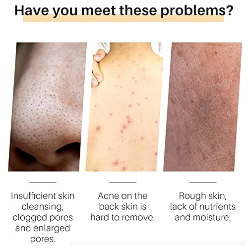 Tratamientos, Beauty Imagen adicional