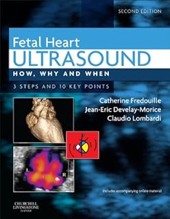 Fetal Heart Ultrasound - E-Book (How, Why and When)