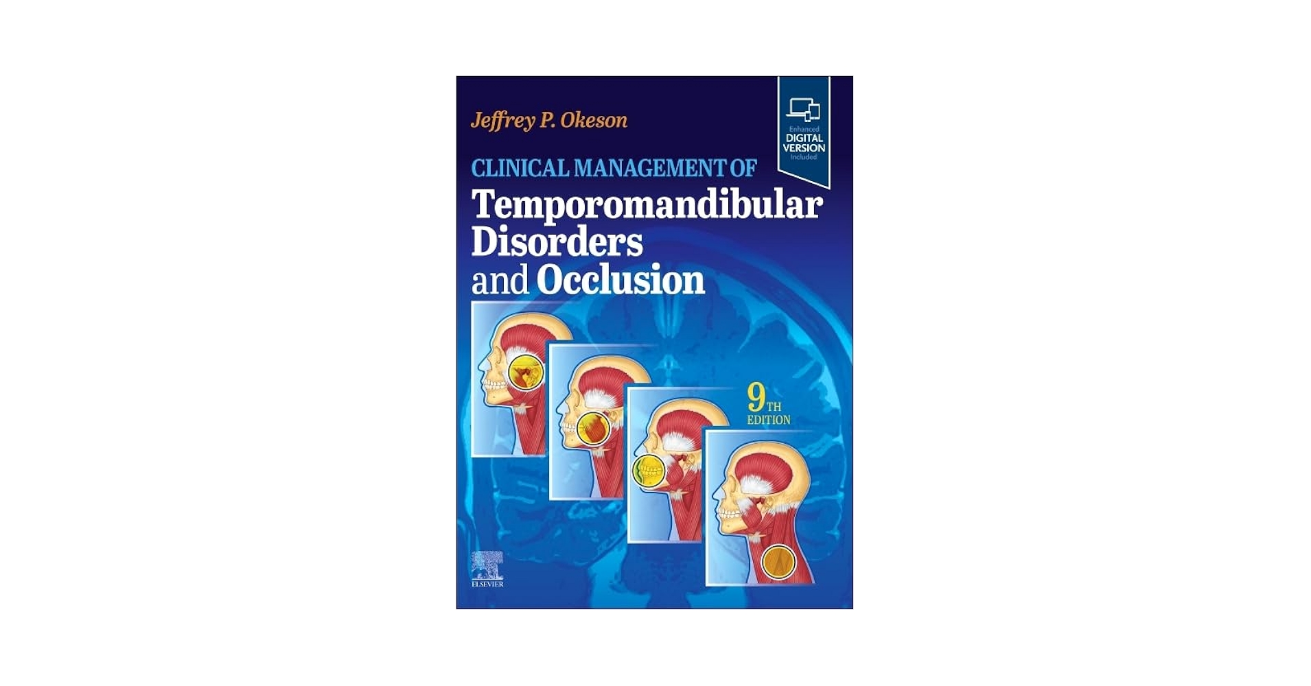 Clinical Management of Temporomandibular Disorders and