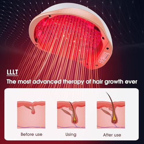 Image of Laser Hair Growth Helmet, Laser Red Light Therapy for Hair Growth, Laser Cap for Hair Regrowth Stimulate Denser Fuller Hair,256 Laser Diodes