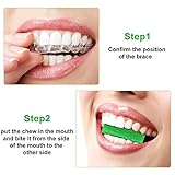 10 Stücke Aligner Chewies für Aligner Chompers Aligner Tablett Sitzer Chewies (Grün)