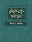 Farbe: Grau Grey The Rapid Cure of Aneurism by Pressure: Illustrated by the Case of Mark Wilson, Who Was Cured of Aneurism of the Abdominal Aorta in the Year 1864