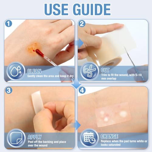 Image of Hydrocolloid Roll, Waterproof Bandage, Wound Dressing, Pimple Patch Roll