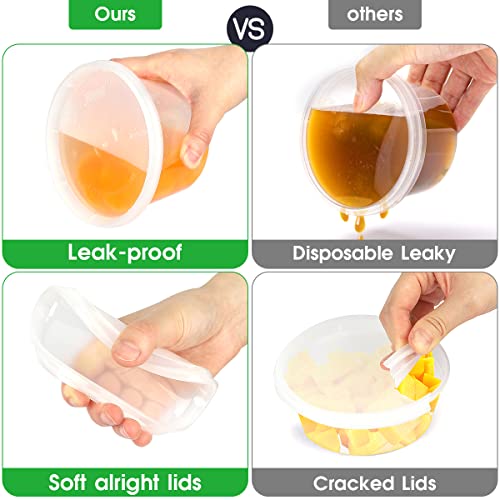 [60 Pack,3 Sizes] Food Storage Containers With Lids, 50 Combo Pack 8Oz, 16Oz, 32Oz Airtight Deli Food Containers W 10 Spoons, Bpa-Free Leakproof Takeout Meal Prep Dishwasher, Microwave, Freezer Safe #TOP4