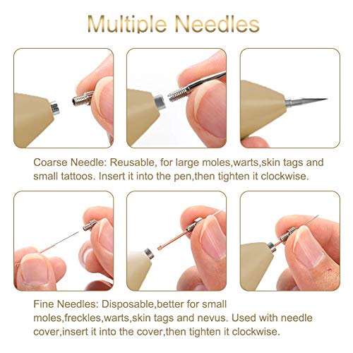 Muttermal Entfernen, Warzen Entfernen, Mole Removal mit 9 Stärke Stufen für alle Arten von haut-tag (Warzen, Muttermale… - Image 5