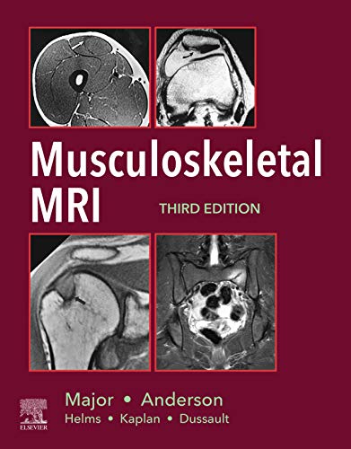 Musculoskeletal MRI E-Book Musculoskeletal MRI E-Book