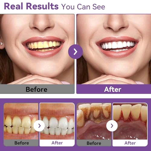Image of Teeth Whitening Powder with 20,000ppm Hydroxyapatite & 20,000ppm Niacinamide, Purple Tooth Powder for Surface Stain Removal, Fresh Mint Flavor, 1.76 oz