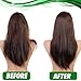 Tea Tree Shampoo and Conditioner Set – with 100% Pure Australian Tea Tree Oil - Anti Dandruff Sulfate and Paraben Free - Dry Scalp Treatment with Keratin, Vitamin B5, Collagen for Women and Men