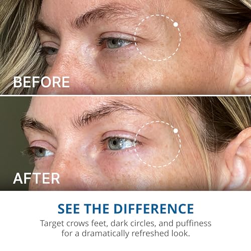 Gopure Advanced Repair Eye Cream - Under Eye Cream For Puffiness thumb #5