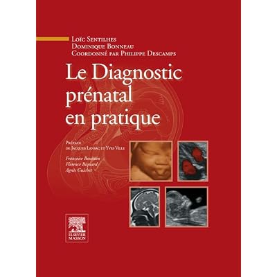 Le Diagnostic pr&eacute;natal en pratique