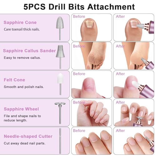 Rolokit Kit Profissional de Manicure E Pedicure com Base de Carregamento, Conjunto de Brocas Elétric