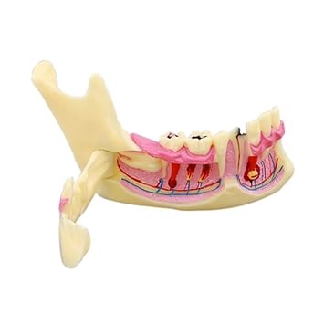 Dental Low Jaw Endodontic Model Anatomical Model of Right Mandibular Tissue Anatomical of Gingiva for Learning And Teaching