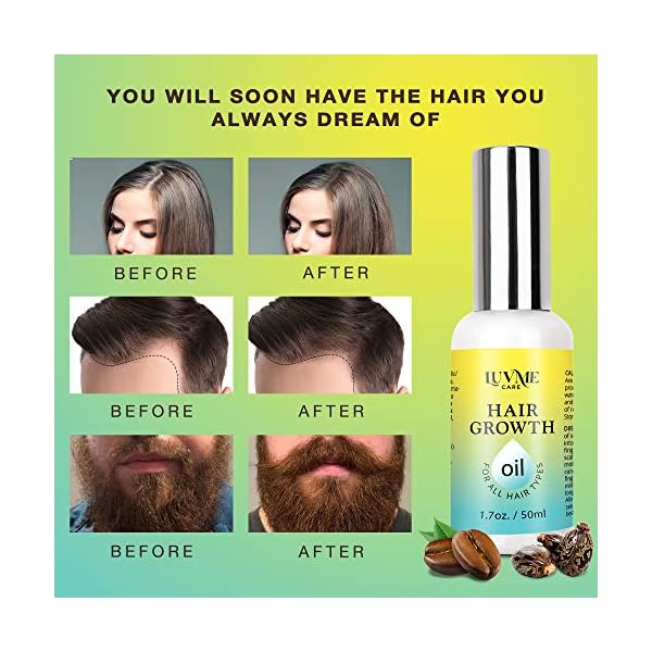 Luv-Me-Care-Biotin-Hair-Growth-Oil-Hair-Growth-Serum-for-Thicker-Longer-Fuller-Healthier-Hair-Prevent-Hair-Loss-Thinning-All-Natural-Vitamin-Rich-Treatment-Women-Men-All-Hair-Types-17-oz Luv Me Care Biotin Hair Growth Oil Hair Growth Serum for Thicker Longer Fuller Healthier Hair, Prevent Hair Loss & Thinning, All Natural Vitamin Rich Treatment, Women & Men, All Hair Types 1.7 oz