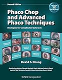 Phaco Chop and Advanced Phaco Techniques: Strategies for Complicated Cataracts