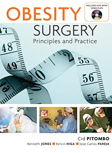 Obesity Surgery: Principles and Practice view 2