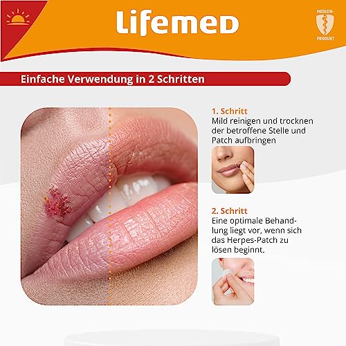 Lifemed Lippen Herpes Patch | Diskreter Schutz und beschleunigte Wundheilung für Lippenherpes Bläschen | Effektiver Herpes Patch gegen Gesichtsherpes | Nahezu unsichtbar - 60 Stück (6er Pack)