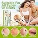 Keloid Bump Removal, Scar Treatment Cream, Silicone Acne Scar Gel, Gentle Effective Aftercare Solution for Injury & Surgery, Skin Repair for Face & Body, 20g