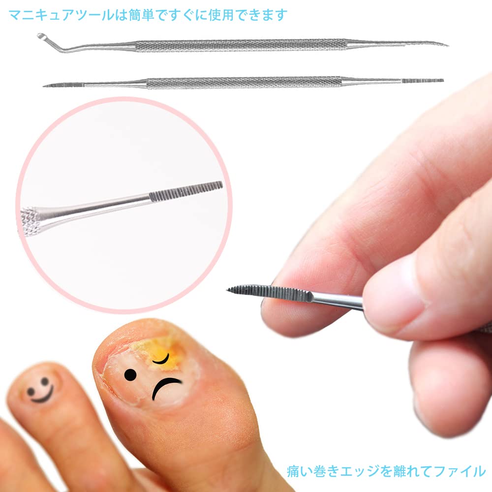 Amazon.co.jp: 爪垢取り 巻き爪 やすり 巻き爪専用 ゾンデ ステンレス