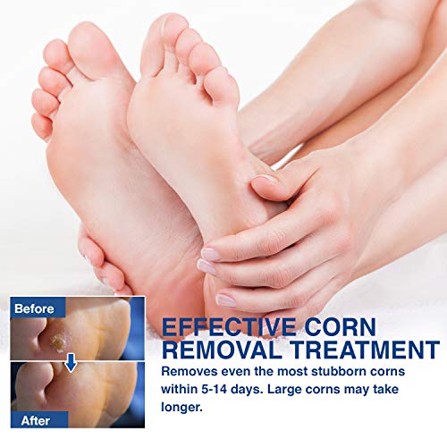 Txl Active Feet Corn Remover, Toe Corn Remover, 30 Pack, Remove Corns Fast, One Step Corn Removers For Feet And Toe, Cushioning Protection Against Shoe Pressure, 30 Pack #TOP1