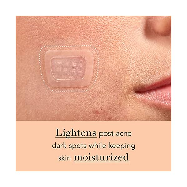 Rael-Microcrystal-Dark-Spot-Cover-Post-Acne-Spots-Skin-Tone-Treatment-Reduce-Redness-with-Skin-Brightening-Ingredients-6-Count Rael Pimple Patches, Miracle Microcrystal Spot Cover - Dark Spot Corrector, Hydrocolloid, Post Acne, with Skin Brightening, for All Skin Types, Vegan, Cruelty Free (6 Count)