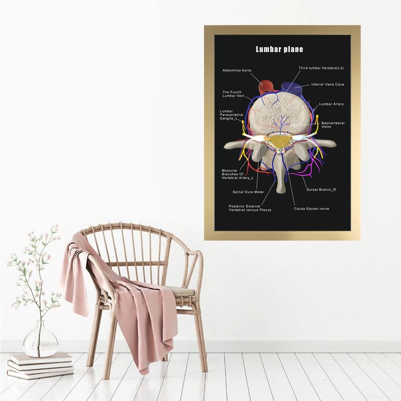 Image of Taanfu Body Educational Learning Anatomy Posters ，Lumbar Plane Art Lumbar Villi Anatomy Art Poster Digestive System Organs Illustration Small Intestine Physiology Anatomy Wall Art Villi