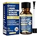 MEOLY Fast-Acting Wart Remover Freeze Off : Salicylic Acid Wart Remover for Plantar Wart, Corn Freeze Off Fast-Acting for Men and Women 30 ML