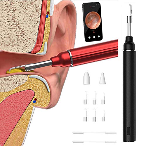 Visuelles Ohr Pick, Wireless-LAN-Ohr-Otoskop, Ohr-Kamera-Objektiv, Ohr Inspektion Endoskop, 6-Achsen-Gyroskop Earwax Removal Kits Für iPhone,