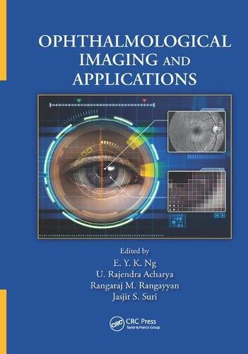 Ophthalmological Imaging and Applications