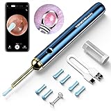 【Otoscopio Professionale da 3.5 mm】 obiettivo professionale grandangolare a 360 °, che creano una visione più ampia e immagini.che può facilmente e comodamente in profondità nel condotto uditivo fino alla membrana timpanica, che è adatto a diverse dimensioni dell'orecchio