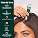 Rene Furterer Triphasic Progressive Concentrated Serum for Hereditary, Hormonal Thinning Hair - Drug-Free - Receding Hairline - Leave-In - Sulfate, Paraben, Silicone-Free - 8 ct., 30-Day Supply