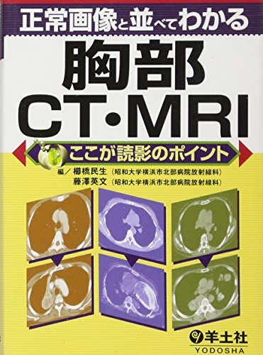 キンドル 無料電子書籍 正常画像と並べてわかる胸部CT・MRI―ここが読影のポイント バイ
