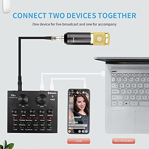 rzoizwko BM-800 Mikrofon Studio Aufnahmekits Kondensatormikrofon für Computer Phantomspeisung BM-800 Karaoke Mikrofon… – Bild 5